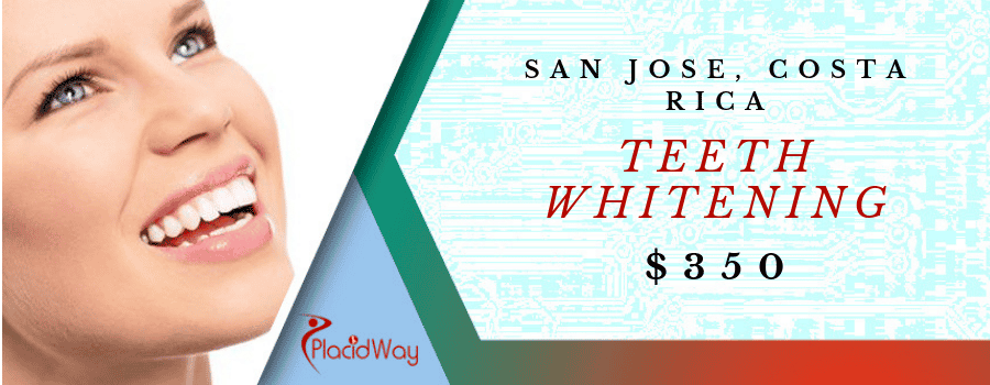 Teeth Whitening in San Jose, Costa Rica Cost